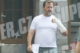 První foto Jaromíra Soukupa po brutálním napadení: Skončil s hrozivými podlitinami a zafixovanou rukou!